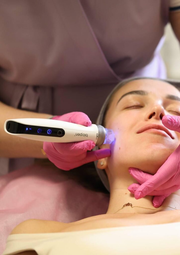 Mezoterapia frakcyjna BioPen